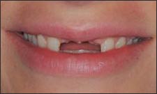 mult teeth Cosmetic Dentistry Dental Implant Centers