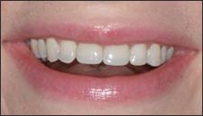 Cosmetic Dentistry Dental Implant Centers