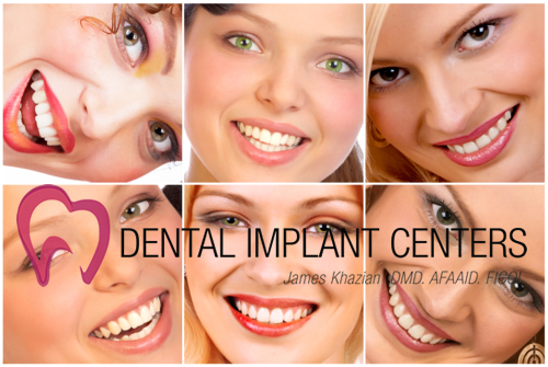 Single Dental Implant Specialists In Denver - Procedure & Product Range