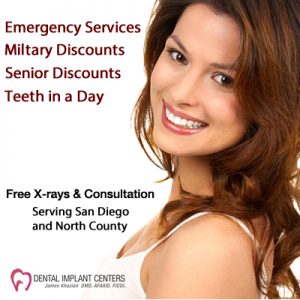 san diego dental implants discounts