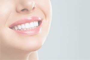 Teeth Smile Allon4 Implants