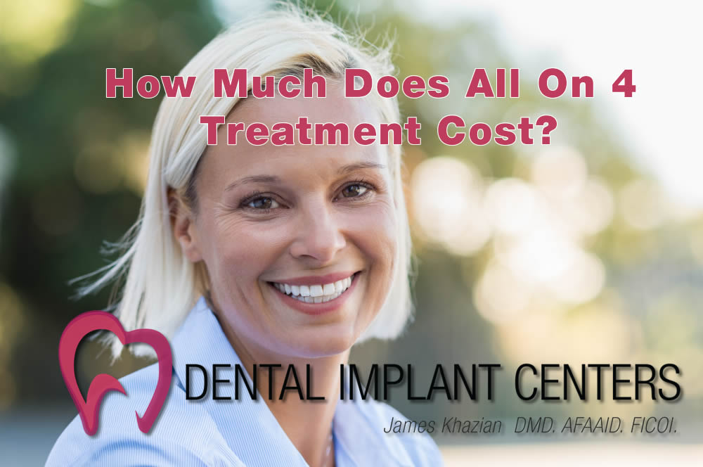 How much does All on 4 treatment cost