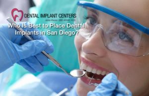 Who Is Best to place dental implant in san diego2