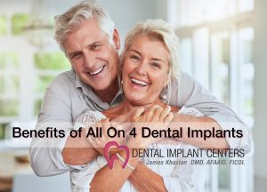 benefits dental implant teeth all on 4