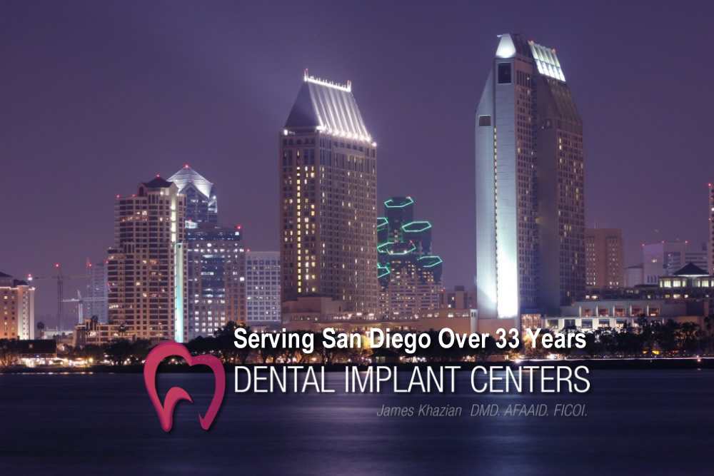dental implants san diego