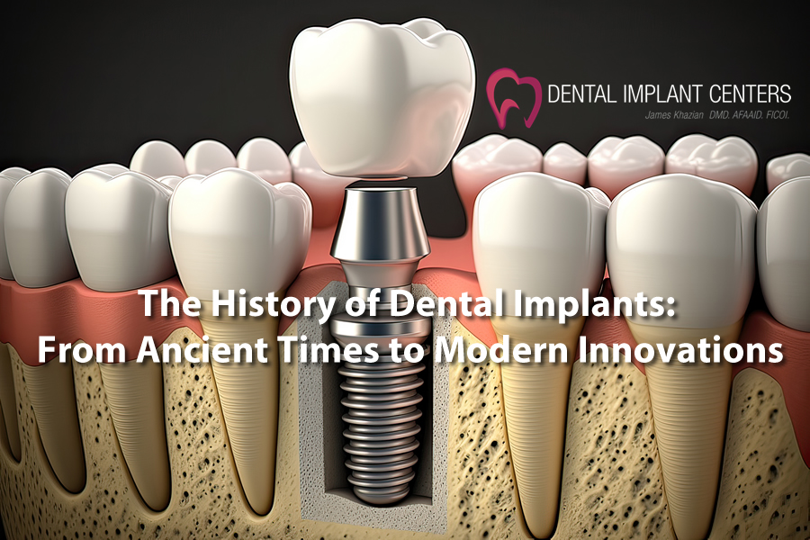 dental implants history