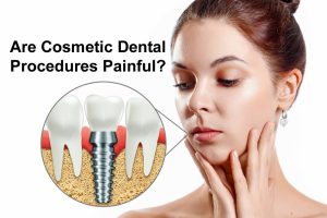 dental implants painful ban