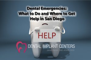 Dental Emergencies: What to Do and Where to Get Help in San Diego