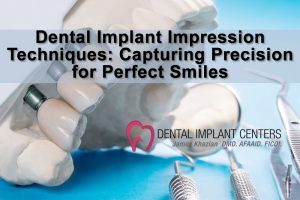 Dental Implant Impression Techniques