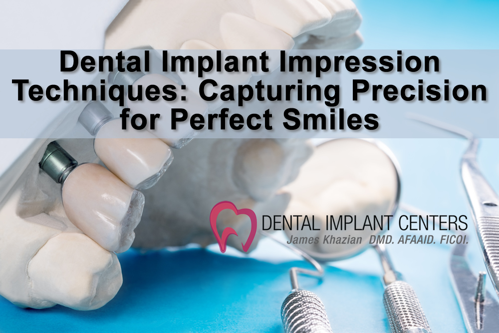 Dental Implant Impression Techniques