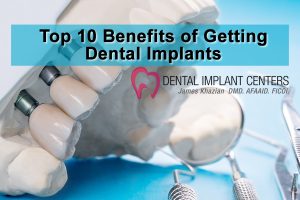 Top 10 Benefits of Getting Dental Implants ban