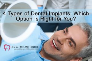 4 Types of Dental Implants: Which Option Is Right for You?