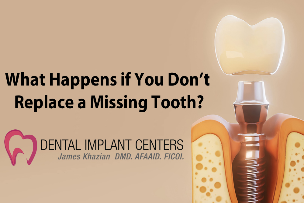What Happens if you Dont Replace Missing Tooth