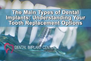The Main Types of Dental Implants: