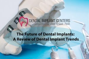 The Future of Dental Implants