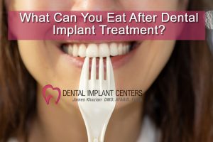 what can you eat dental implants