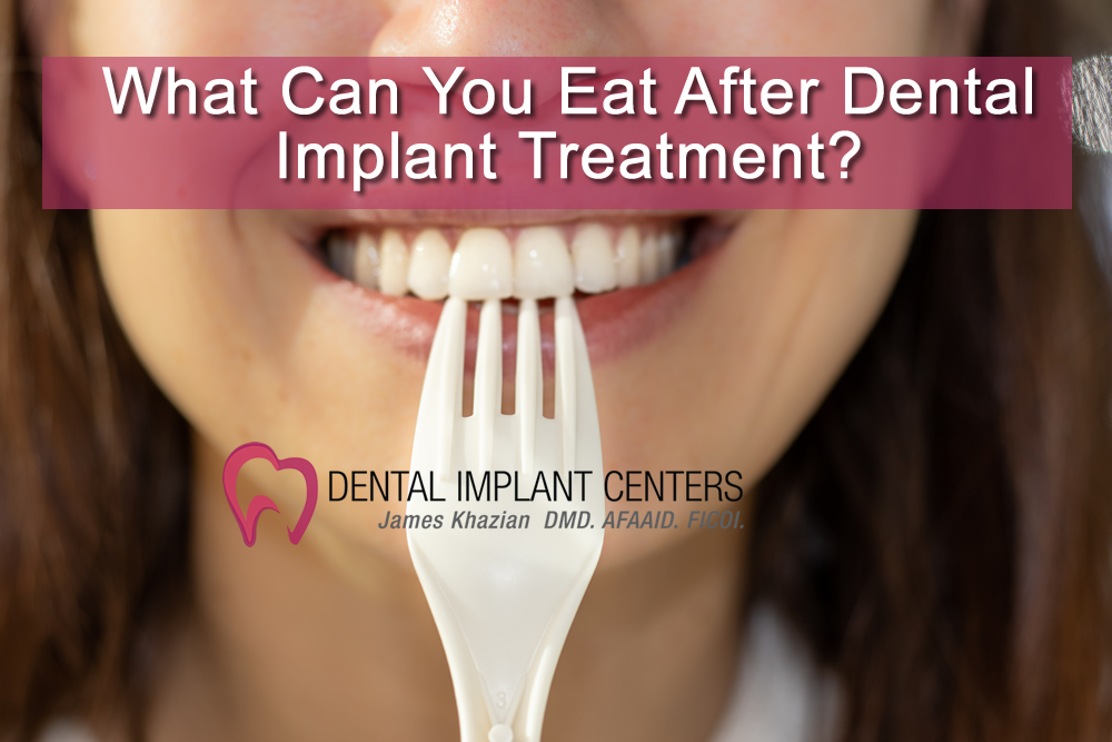 what can you eat dental implants