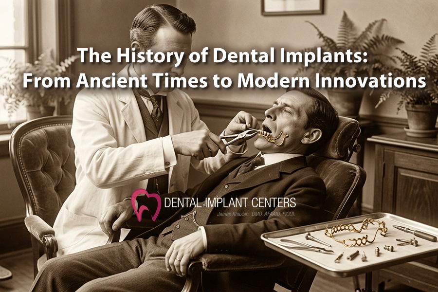 History dental implants